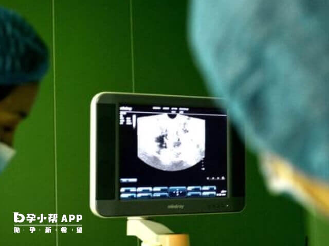 促排卵是试管过程中最关键步骤