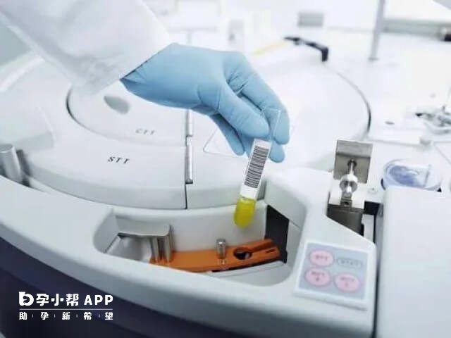 男方精液检查次数