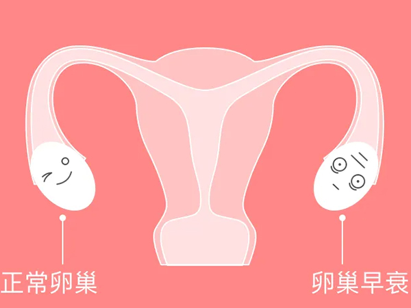 卵巢早衰患者可以做供卵助孕