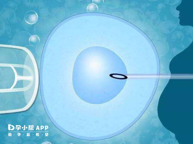 公立医院供卵需要等到3至5年